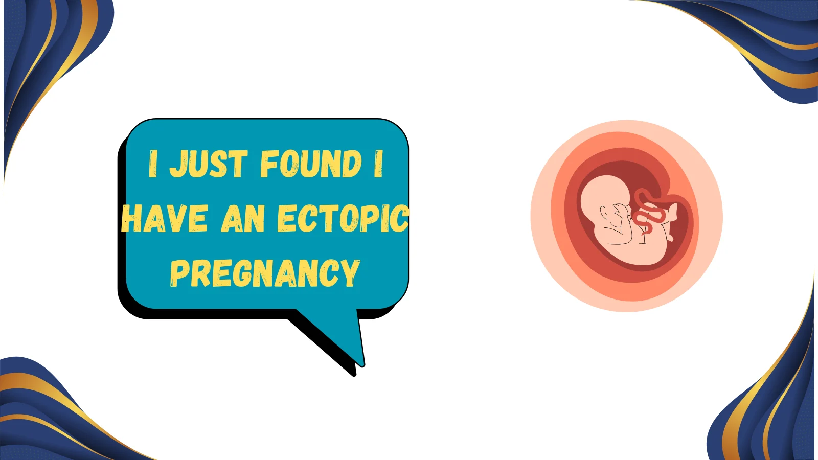 ectopic pregnancy meaning